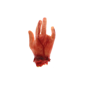 MANO DEDO AMPUTADO